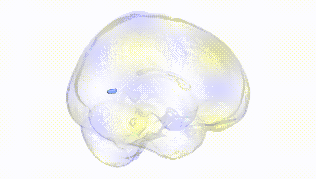 Full Brain White