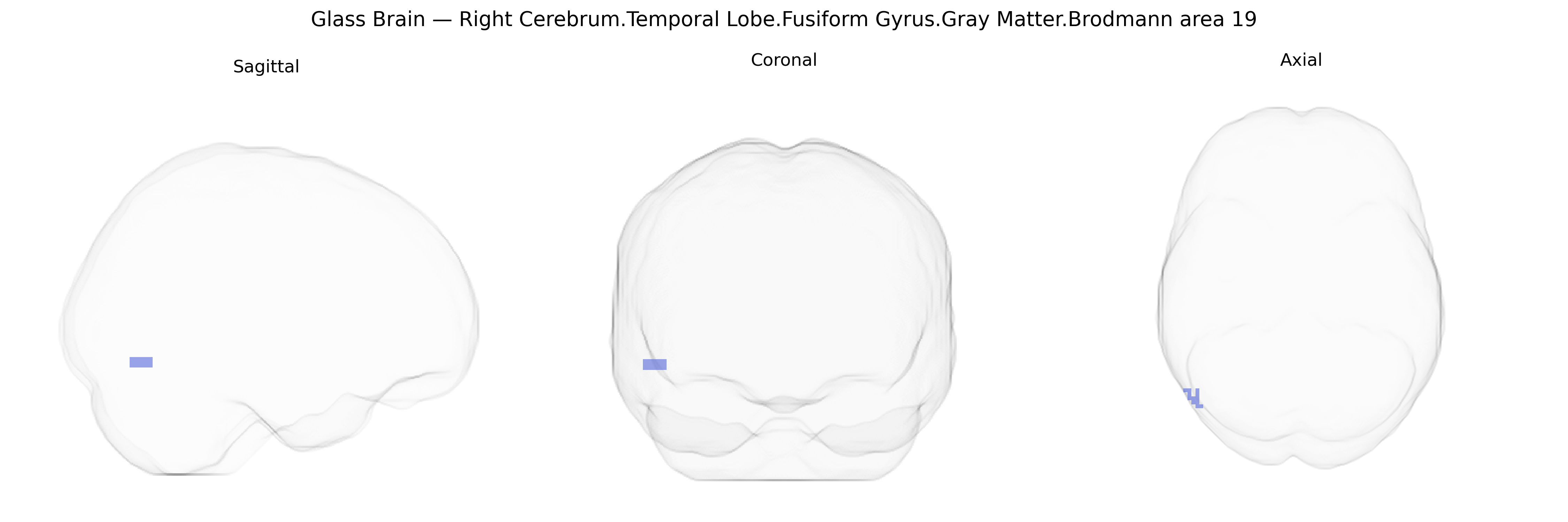 Triplanar Ghost Brain