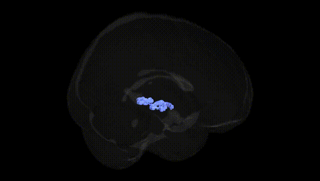 Full Brain Black