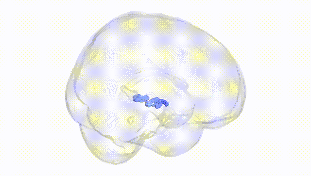 Full Brain White