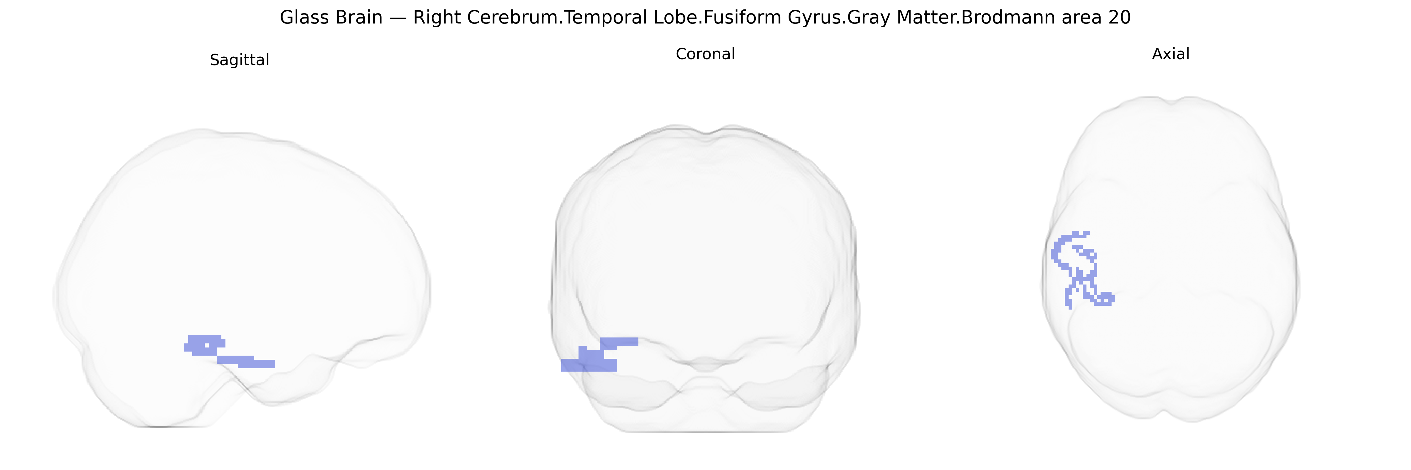 Triplanar Ghost Brain