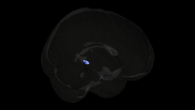 Full Brain Black