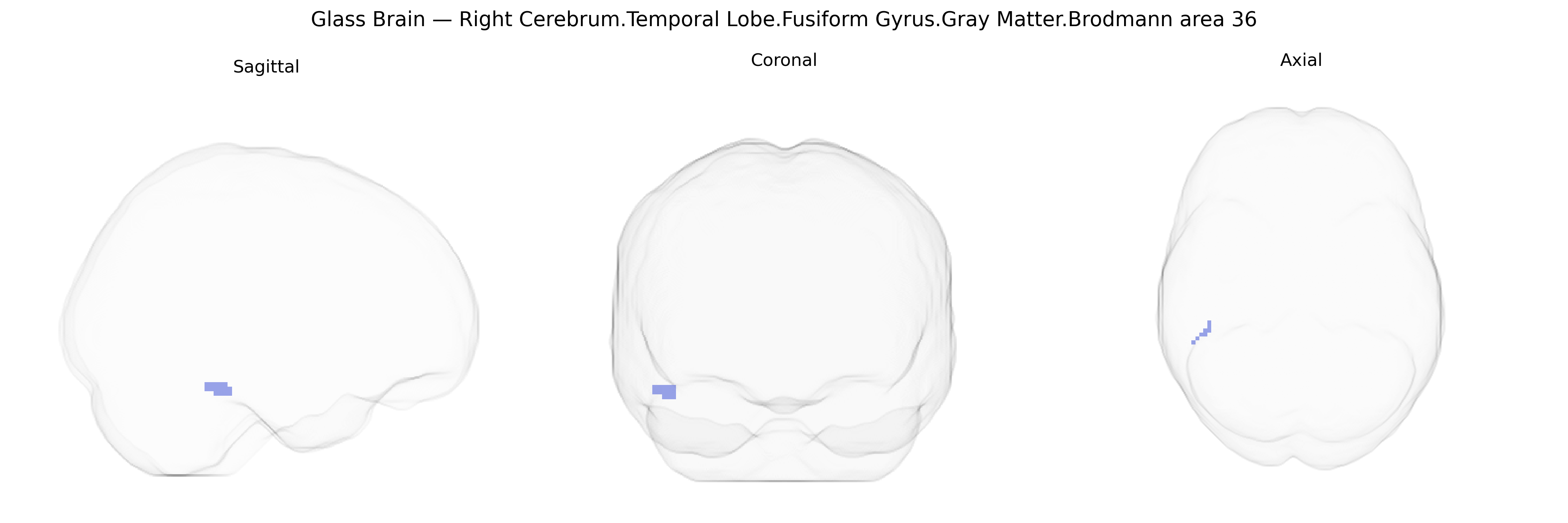 Triplanar Ghost Brain