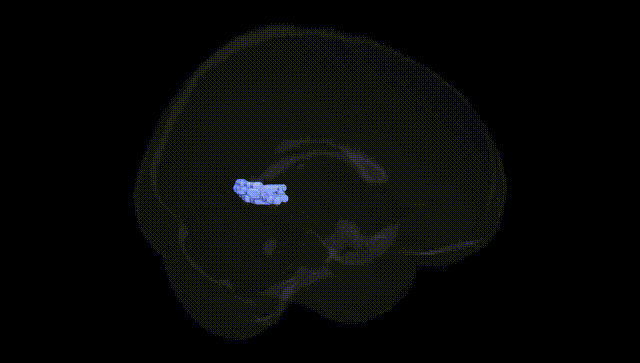 Full Brain Black