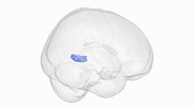 Full Brain White