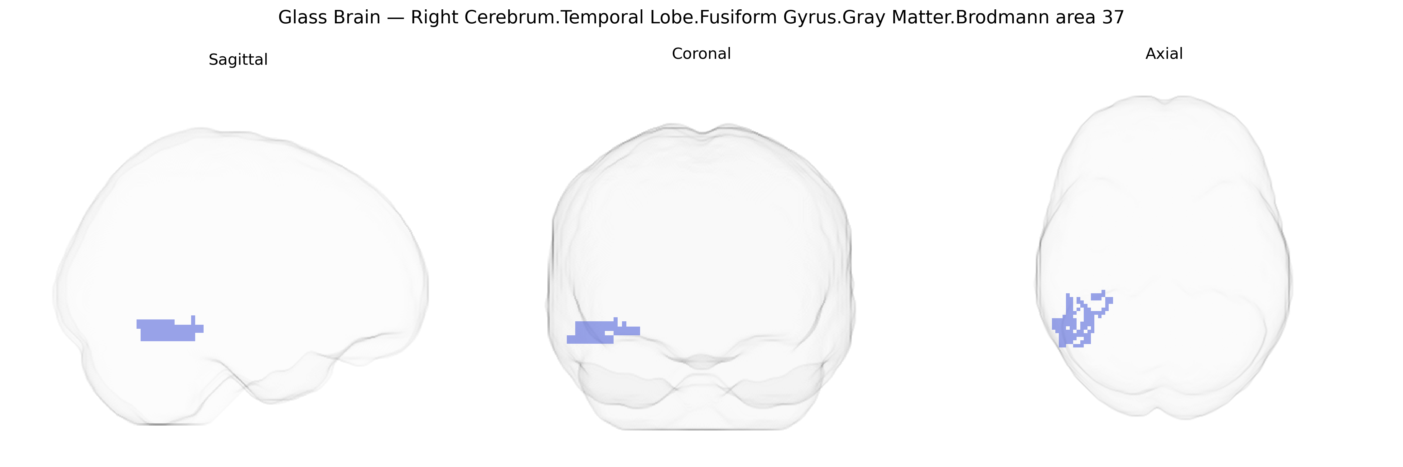 Triplanar Ghost Brain