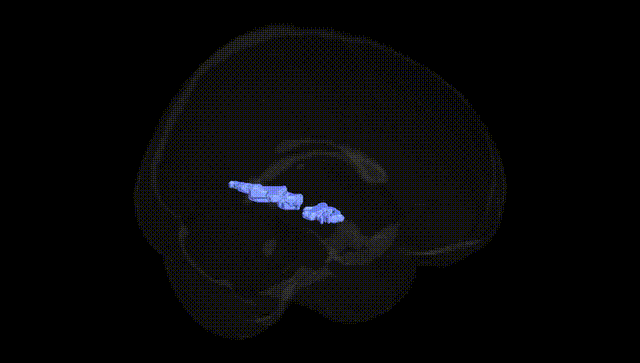 Full Brain Black