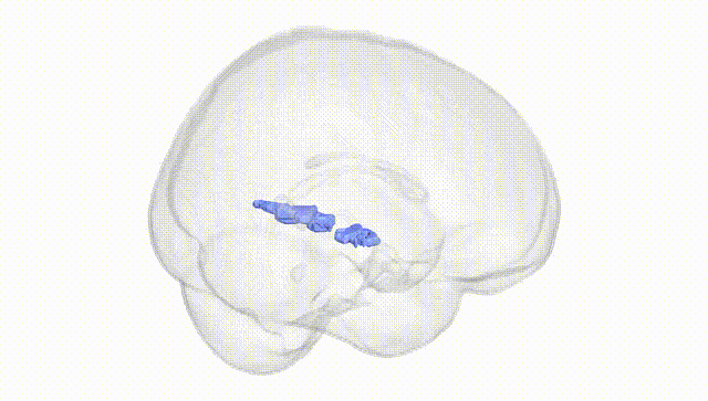 Full Brain White