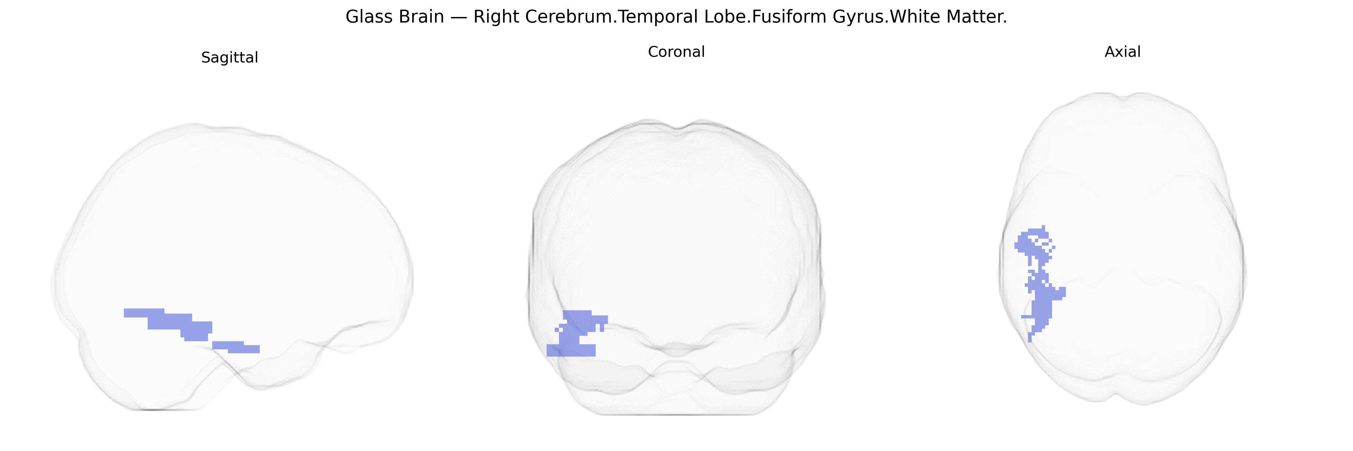 Triplanar Ghost Brain