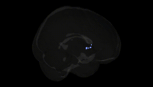 Full Brain Black