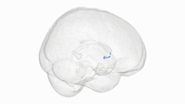 Full Brain White