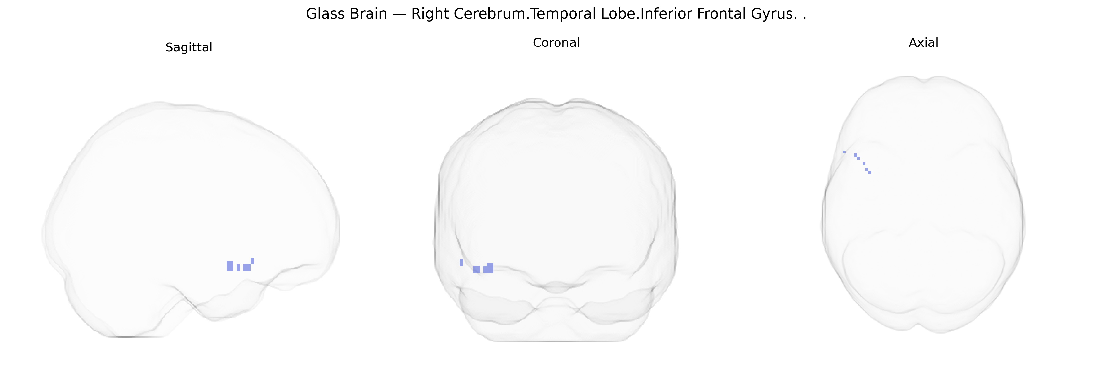 Triplanar Ghost Brain