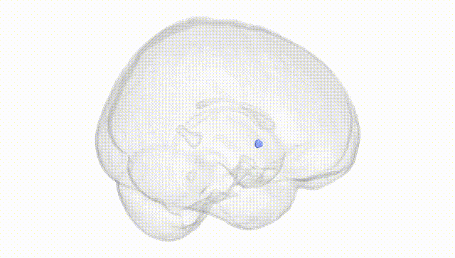 Full Brain White