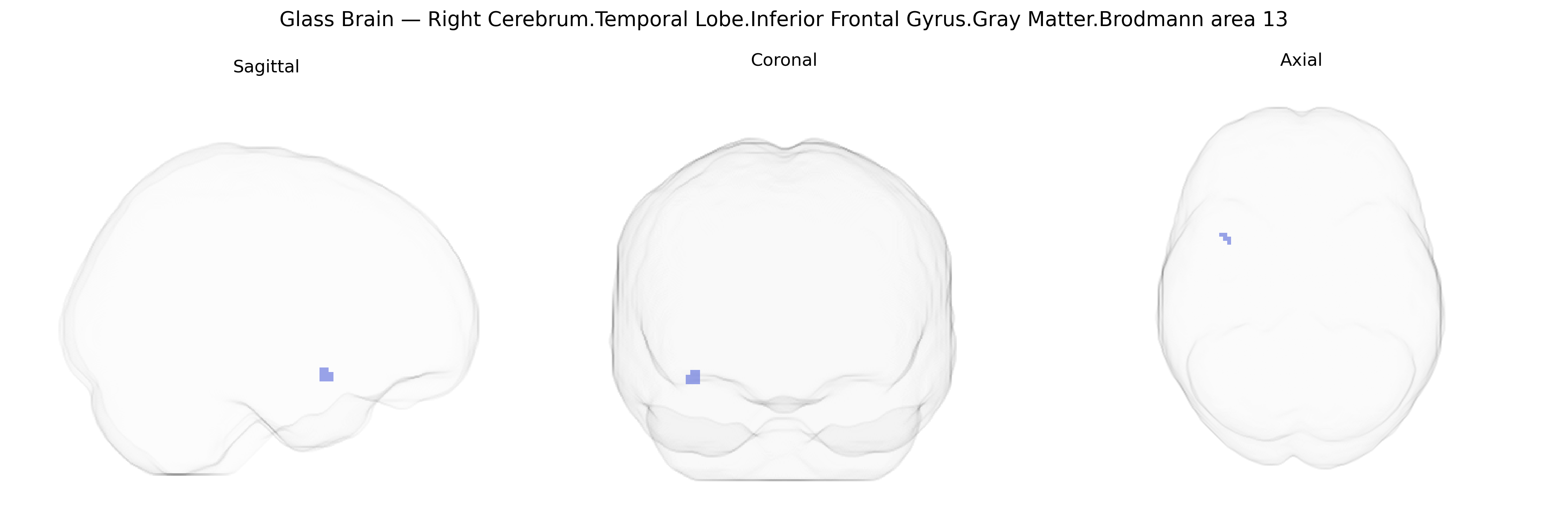 Triplanar Ghost Brain