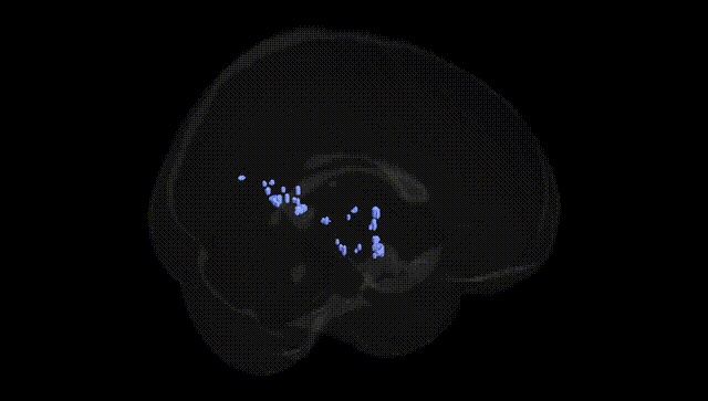Full Brain Black