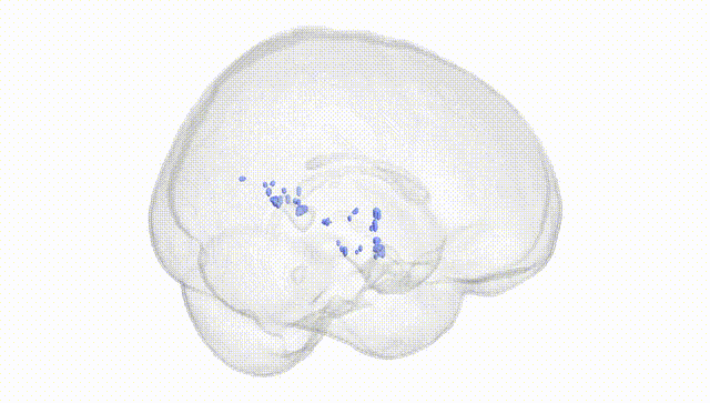 Full Brain White