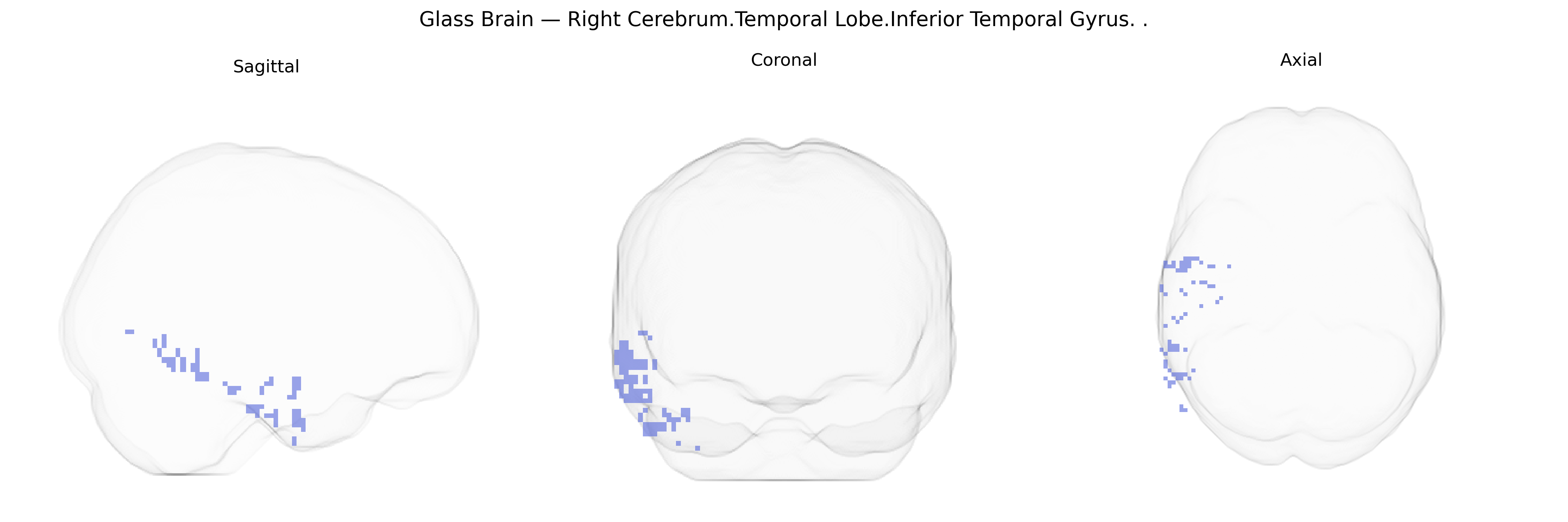 Triplanar Ghost Brain