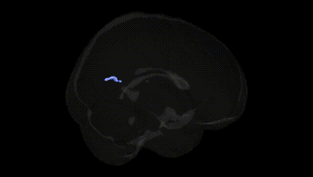 Full Brain Black