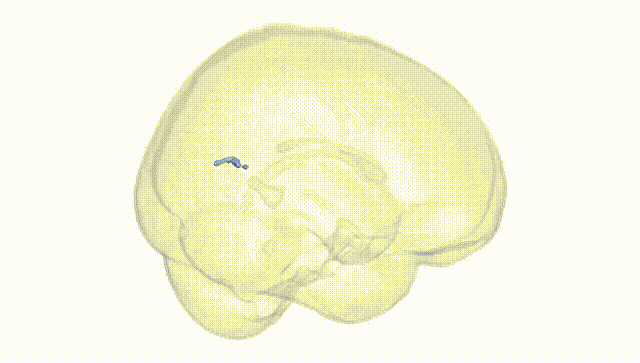 Full Brain White