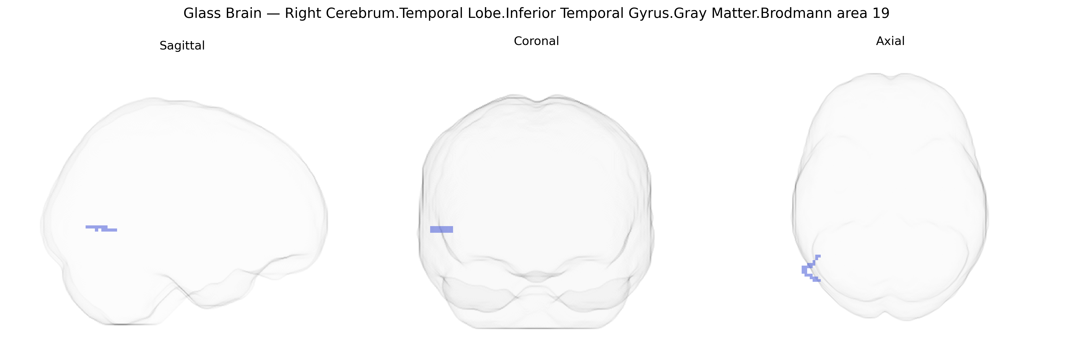 Triplanar Ghost Brain