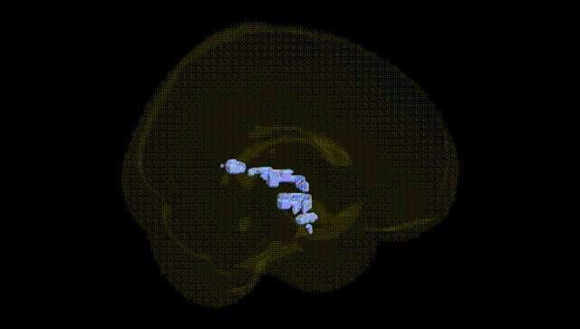 Full Brain Black