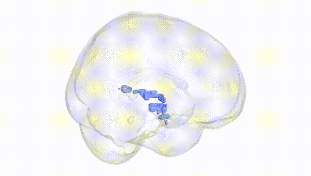 Full Brain White