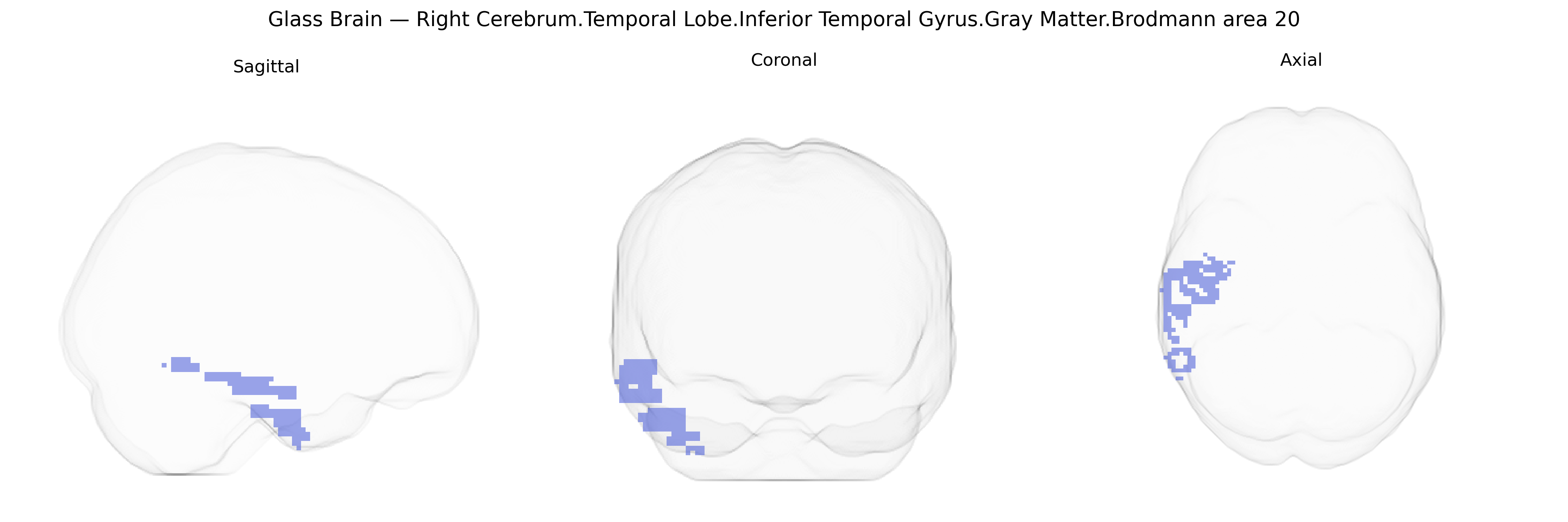 Triplanar Ghost Brain