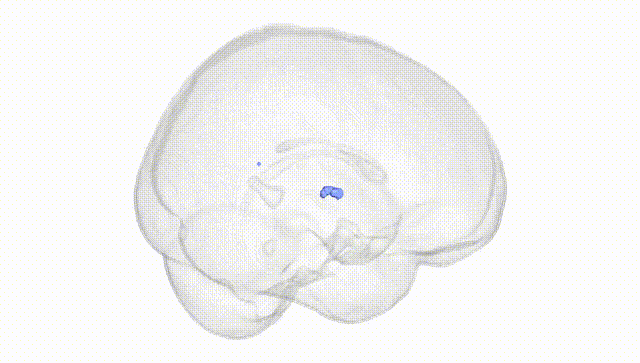 Full Brain White