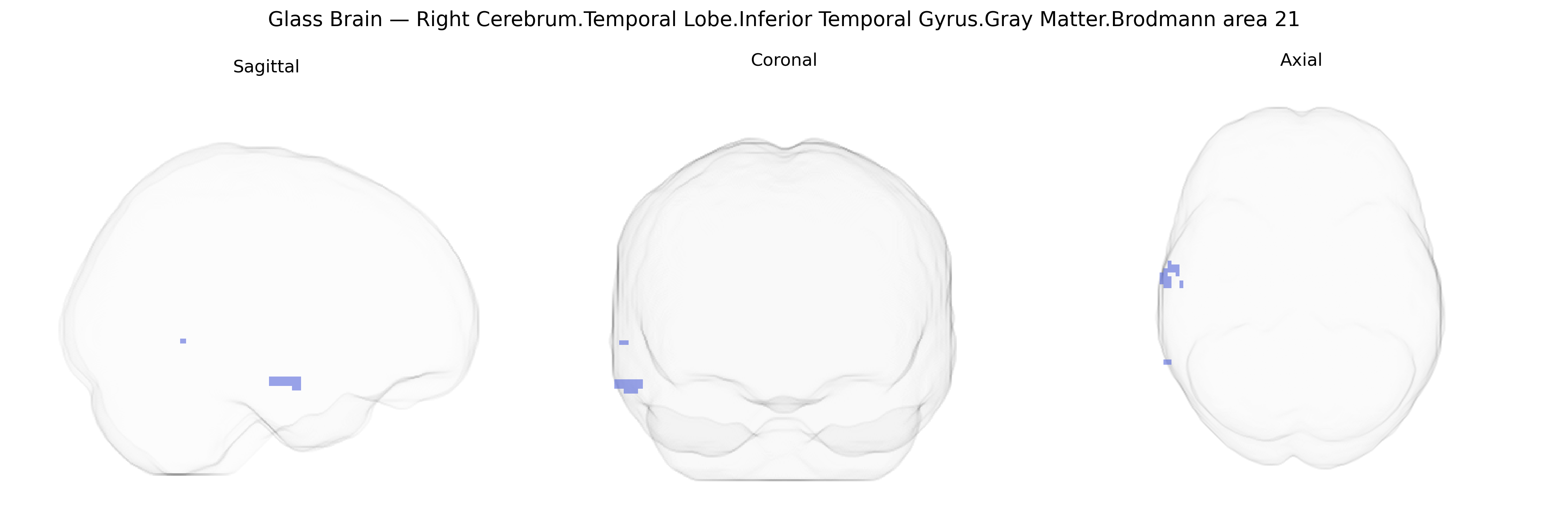 Triplanar Ghost Brain