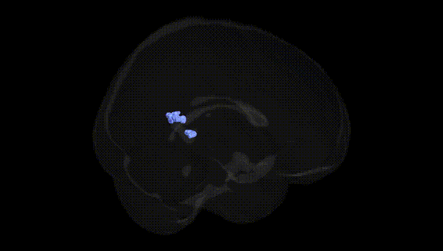 Full Brain Black
