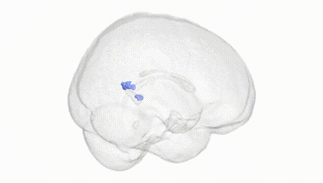 Full Brain White
