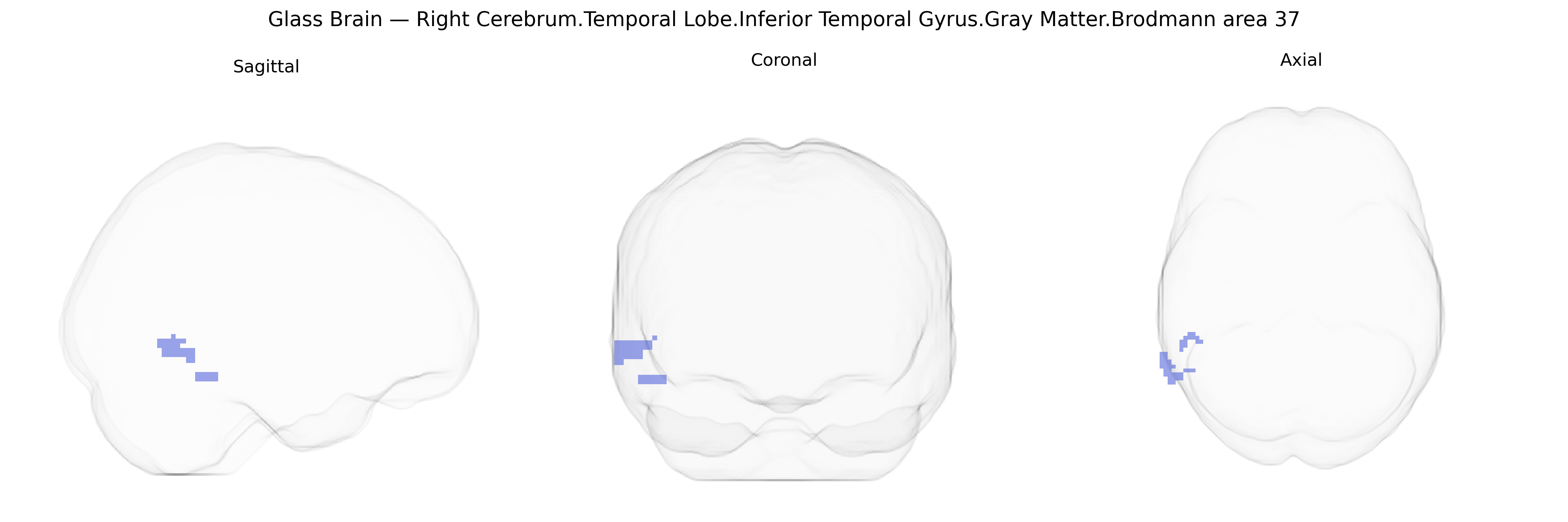 Triplanar Ghost Brain