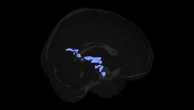 Full Brain Black