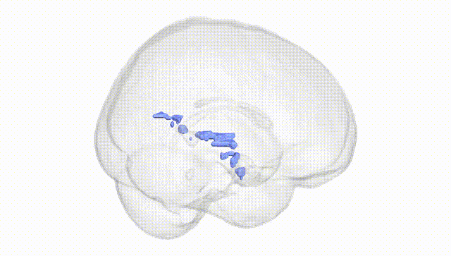 Full Brain White