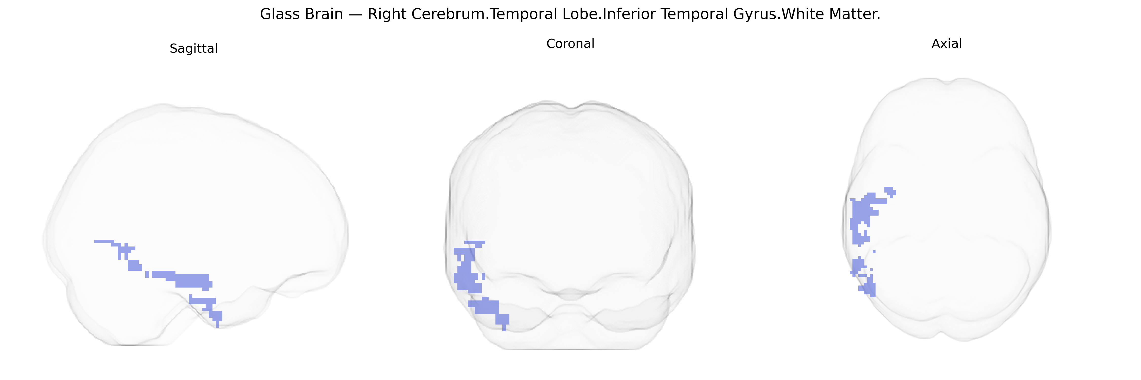 Triplanar Ghost Brain