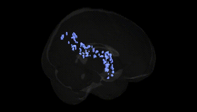 Full Brain Black