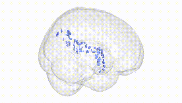 Full Brain White