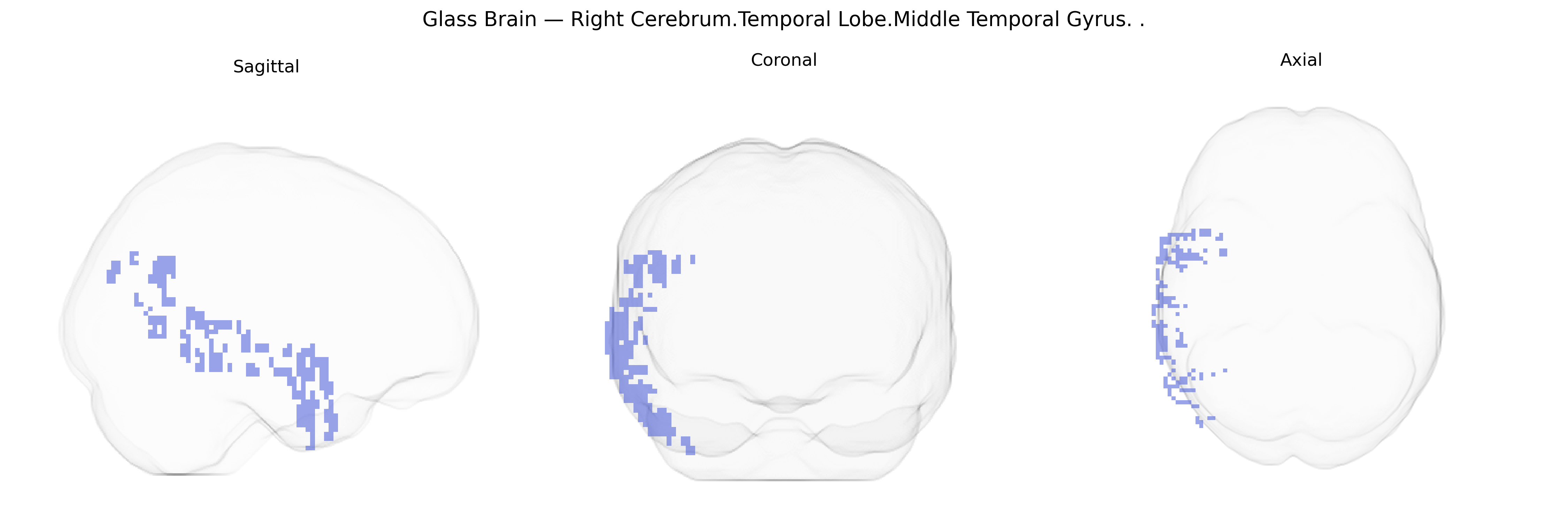 Triplanar Ghost Brain