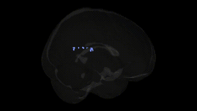 Full Brain Black