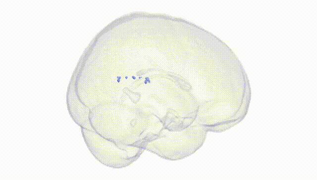 Full Brain White