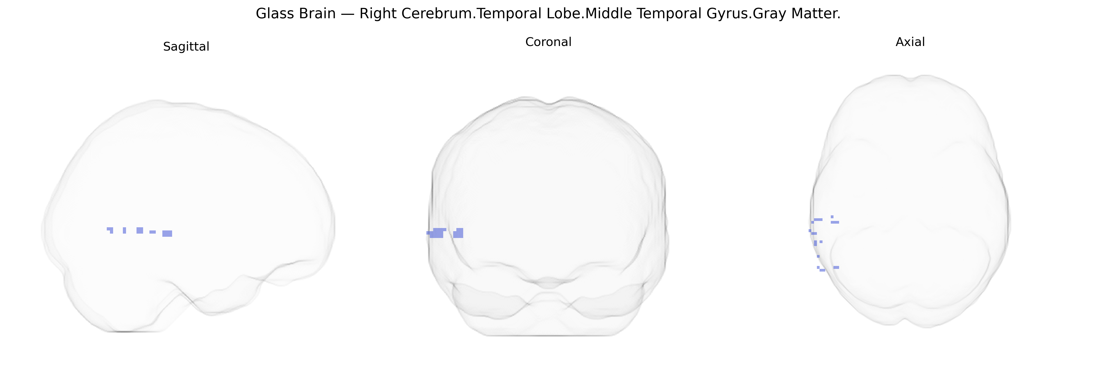 Triplanar Ghost Brain