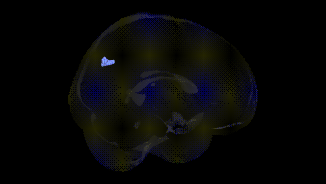 Full Brain Black