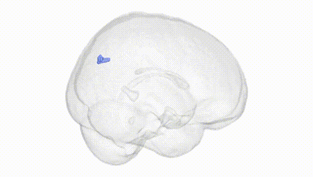 Full Brain White