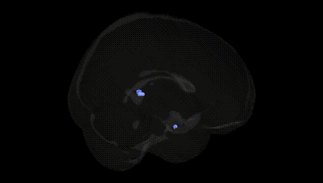 Full Brain Black