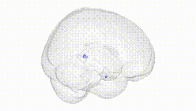 Full Brain White