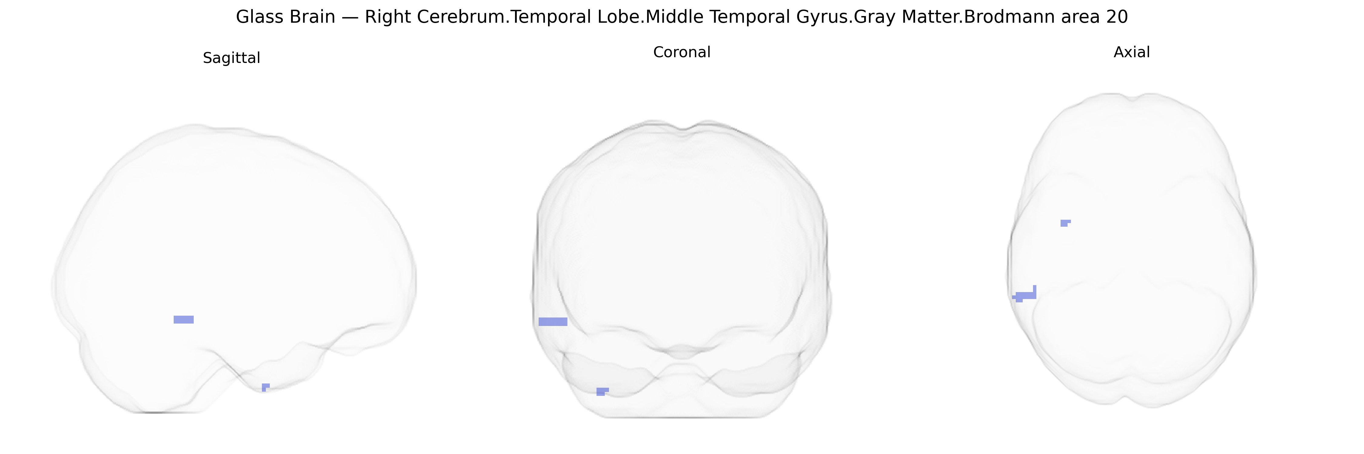 Triplanar Ghost Brain
