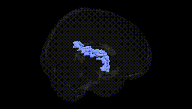 Full Brain Black