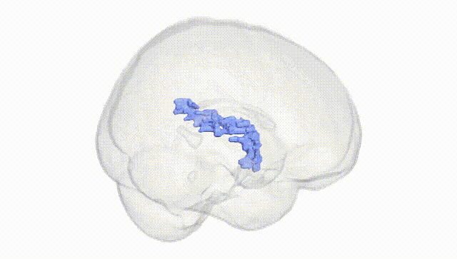 Full Brain White