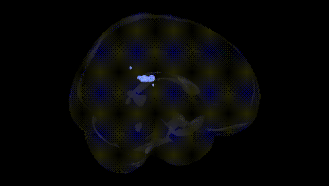Full Brain Black