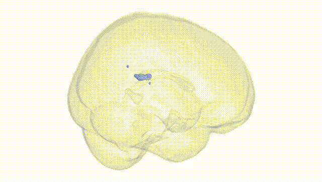 Full Brain White